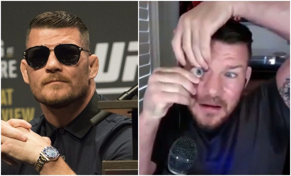 michael bisping fake eye - MMAnytt.com