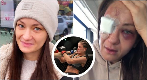Karolina Kowalkiewicz shows off GRUESOME eye injury following last loss